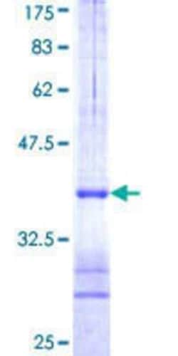Novus Biologicals Recombinant Human RNF160 GST (N-Term) Protein 10 &mu;g | Buy Online | Novus Biologicals&trade; | Fisher Scientific