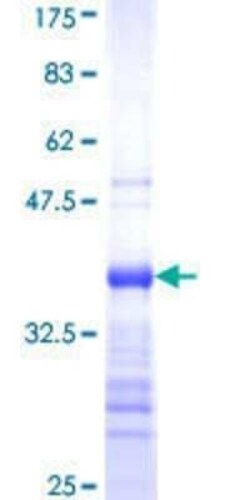 Novus Biologicals Recombinant Human ZNF500 GST (N-Term) Protein 10 &mu;g | Buy Online | Novus Biologicals&trade; | Fisher Scientific