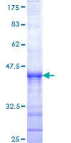 Novus Biologicals Recombinant Human SENP6 GST (N-Term) Protein 10 &mu;g | Buy Online | Novus Biologicals&trade; | Fisher Scientific