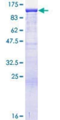 Novus Biologicals Recombinant Human ANKRD17 GST (N-Term) Protein 25 &mu;g | Buy Online | Novus Biologicals&trade; | Fisher Scientific