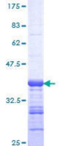 Novus Biologicals Recombinant Human ANKRD17 GST (N-Term) Protein 10 &mu;g | Buy Online | Novus Biologicals&trade; | Fisher Scientific