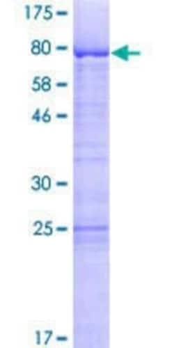 Novus Biologicals Recombinant Human LSM14A GST (N-Term) Protein 2 &mu;g | Buy Online | Novus Biologicals&trade; | Fisher Scientific