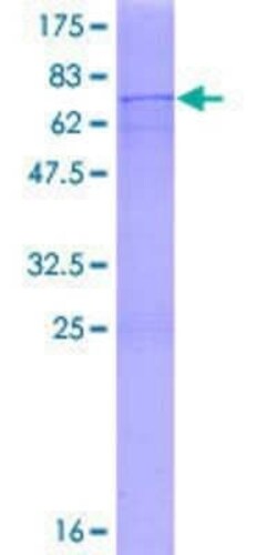 Novus Biologicals Recombinant Human POLDIP2 GST (N-Term) Protein 2 &mu;g | Buy Online | Novus Biologicals&trade; | Fisher Scientific