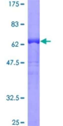 Novus Biologicals Recombinant Human GPSM1 GST (N-Term) Protein 10 &mu;g | Buy Online | Novus Biologicals&trade; | Fisher Scientific