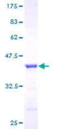 Novus Biologicals Recombinant Human GGA1 GST (N-Term) Protein 25 &mu;g | Buy Online | Novus Biologicals&trade; | Fisher Scientific