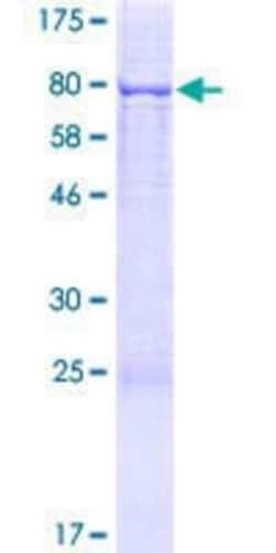 Novus Biologicals Recombinant Human LAP1B GST (N-Term) Protein 2 &mu;g | Buy Online | Novus Biologicals&trade; | Fisher Scientific