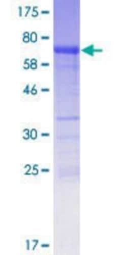 Novus Biologicals Recombinant Human Pygopus-1 GST (N-Term) Protein 10 &mu;g | Buy Online | Novus Biologicals&trade; | Fisher Scientific