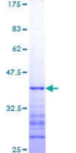Novus Biologicals Recombinant Human Pygopus-1 GST (N-Term) Protein 25 &mu;g | Buy Online | Novus Biologicals&trade; | Fisher Scientific