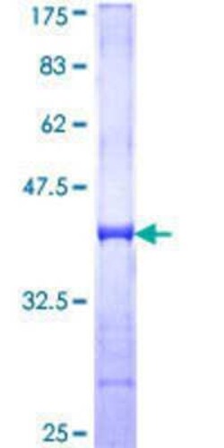 Novus Biologicals Recombinant Human WSB1 GST (N-Term) Protein 10 &mu;g | Buy Online | Novus Biologicals&trade; | Fisher Scientific