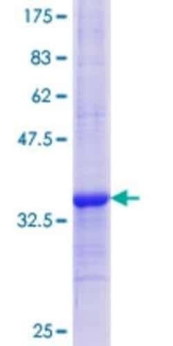 Novus Biologicals Recombinant Human WSB1 GST (N-Term) Protein 25 &mu;g | Buy Online | Novus Biologicals&trade; | Fisher Scientific