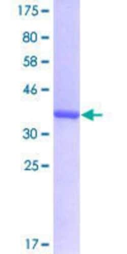 Novus Biologicals Recombinant Human PRPF31 GST (N-Term) Protein 10 &mu;g | Buy Online | Novus Biologicals&trade; | Fisher Scientific