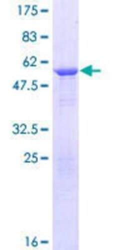 Novus Biologicals Recombinant Human FGFR1OP2 GST (N-Term) Protein 25 &mu;g | Buy Online | Novus Biologicals&trade; | Fisher Scientific