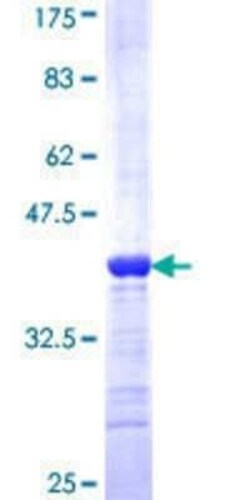 Novus Biologicals Recombinant Human FGFR1OP2 GST (N-Term) Protein 25 &mu;g | Buy Online | Novus Biologicals&trade; | Fisher Scientific