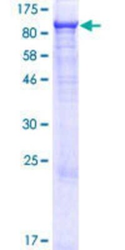 Novus Biologicals Recombinant Human RAP6 GST (N-Term) Protein 10 &mu;g | Buy Online | Novus Biologicals&trade; | Fisher Scientific