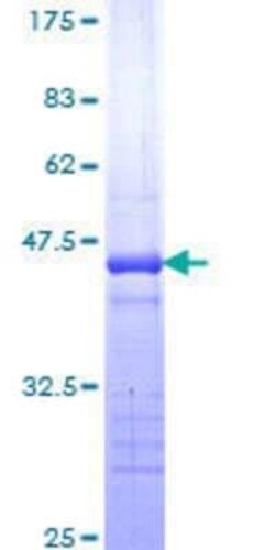 Novus Biologicals Recombinant Human TRUSS GST (N-Term) Protein 10 &mu;g | Buy Online | Novus Biologicals&trade; | Fisher Scientific