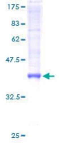 Novus Biologicals Recombinant Human TTLL3 GST (N-Term) Protein 25 &mu;g | Buy Online | Novus Biologicals&trade; | Fisher Scientific