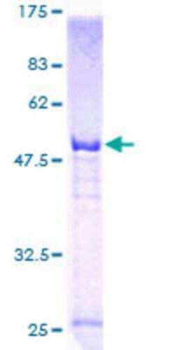 Novus Biologicals Recombinant Human KIF26A GST (N-Term) Protein 10 &mu;g | Buy Online | Novus Biologicals&trade; | Fisher Scientific