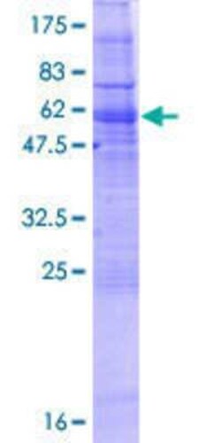 Novus Biologicals Recombinant Human GIMAP2 GST (N-Term) Protein 25 &mu;g | Buy Online | Novus Biologicals&trade; | Fisher Scientific