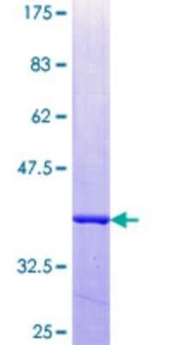 Novus Biologicals Recombinant Human GIMAP2 GST (N-Term) Protein 10 &mu;g | Buy Online | Novus Biologicals&trade; | Fisher Scientific