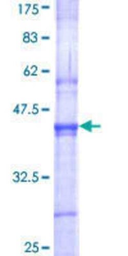 Novus Biologicals Recombinant Human SENP3 GST (N-Term) Protein 2 &mu;g | Buy Online | Novus Biologicals&trade; | Fisher Scientific