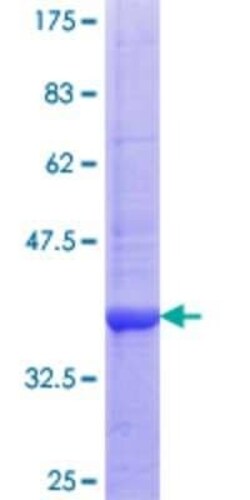 Novus Biologicals Recombinant Human Lyp/PTPN22 GST (N-Term) Protein 25 &mu;g | Buy Online | Novus Biologicals&trade; | Fisher Scientific