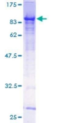 Novus Biologicals Recombinant Human GMEB2 GST (N-Term) Protein 10 &mu;g | Buy Online | Novus Biologicals&trade; | Fisher Scientific