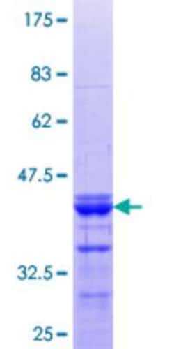 Novus Biologicals Recombinant Human SPAG8 GST (N-Term) Protein 25 &mu;g | Buy Online | Novus Biologicals&trade; | Fisher Scientific