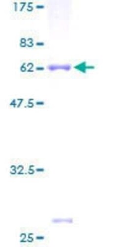 Novus Biologicals Recombinant Human PITPNC1 GST (N-Term) Protein 25 &mu;g | Buy Online | Novus Biologicals&trade; | Fisher Scientific