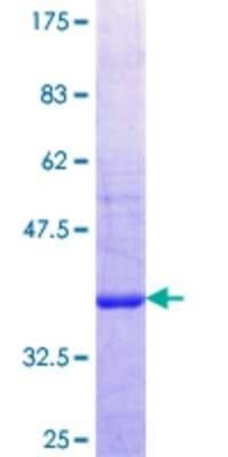 Novus Biologicals Recombinant Human PITPNC1 GST (N-Term) Protein 25 &mu;g | Buy Online | Novus Biologicals&trade; | Fisher Scientific