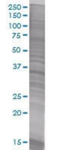 Novus Biologicals PITPNC1 293T Cell Transient Overexpression Lysate 0.1 mL | Buy Online | Novus Biologicals&trade; | Fisher Scientific
