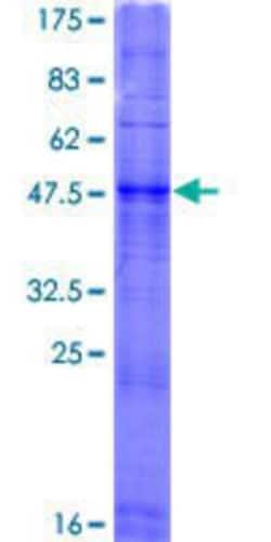 Novus Biologicals&trade;&nbsp;Recombinant Human OR2F1 GST (N-Term) Protein