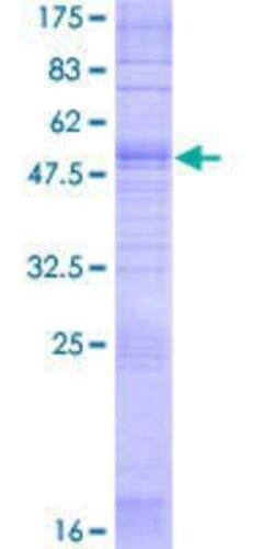 Novus Biologicals Recombinant Human OR2B6 GST (N-Term) Protein 2 &mu;g | Buy Online | Novus Biologicals&trade; | Fisher Scientific