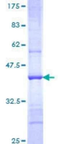 Novus Biologicals Recombinant Human FBXL21 GST (N-Term) Protein 10 &mu;g | Buy Online | Novus Biologicals&trade; | Fisher Scientific