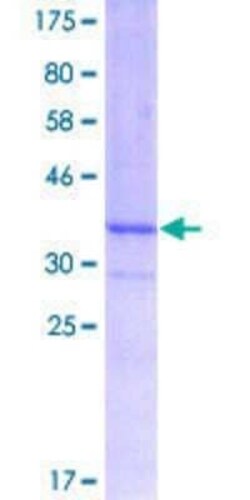 Novus Biologicals Recombinant Human FBXL3 GST (N-Term) Protein 10 &mu;g | Buy Online | Novus Biologicals&trade; | Fisher Scientific