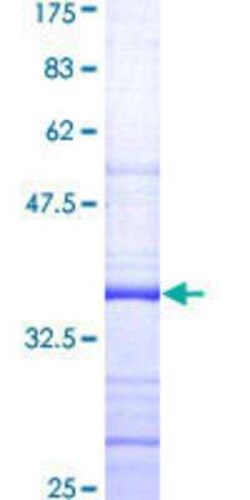Novus Biologicals Recombinant Human SHFM3P1 GST (N-Term) Protein 10 &mu;g | Buy Online | Novus Biologicals&trade; | Fisher Scientific