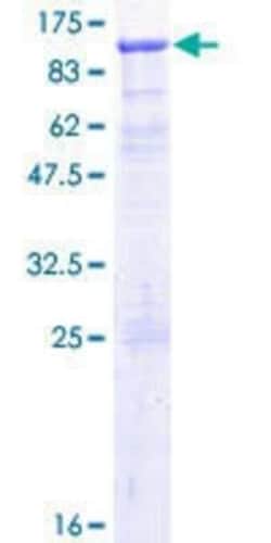 Novus Biologicals Recombinant Human TIAM2 GST (N-Term) Protein 10 &mu;g | Buy Online | Novus Biologicals&trade; | Fisher Scientific