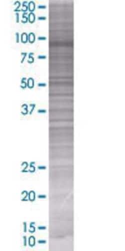 Novus Biologicals TIAM2 293T Cell Transient Overexpression Lysate 0.1 mL | Buy Online | Novus Biologicals&trade; | Fisher Scientific