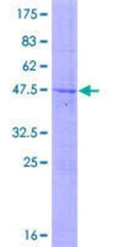 Novus Biologicals Recombinant Human LRRC29 GST (N-Term) Protein 10 &mu;g | Buy Online | Novus Biologicals&trade; | Fisher Scientific