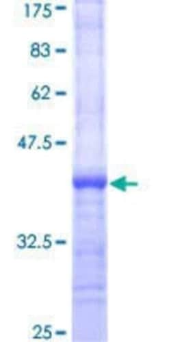 Novus Biologicals Recombinant Human LRRC29 GST (N-Term) Protein 10 &mu;g | Buy Online | Novus Biologicals&trade; | Fisher Scientific