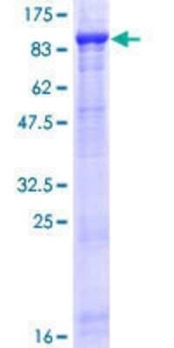 Novus Biologicals Recombinant Human FBXL5 GST (N-Term) Protein 25 &mu;g | Buy Online | Novus Biologicals&trade; | Fisher Scientific