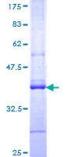 Novus Biologicals Recombinant Human FBXL5 GST (N-Term) Protein 10 &mu;g | Buy Online | Novus Biologicals&trade; | Fisher Scientific