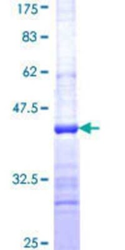Novus Biologicals Recombinant Human FBXL4 GST (N-Term) Protein 25 &mu;g | Buy Online | Novus Biologicals&trade; | Fisher Scientific