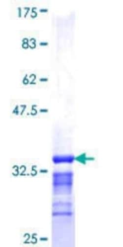 Novus Biologicals Recombinant Human Kelch-Like 3 GST (N-Term) Protein 2 &mu;g | Buy Online | Novus Biologicals&trade; | Fisher Scientific
