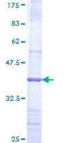 Novus Biologicals Recombinant Human FBXW8 GST (N-Term) Protein 10 &mu;g | Buy Online | Novus Biologicals&trade; | Fisher Scientific