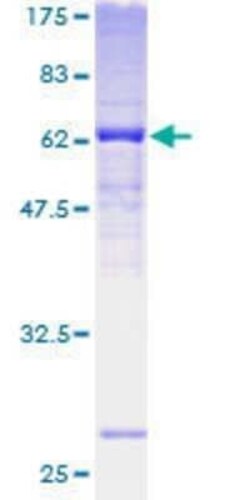 Novus Biologicals Recombinant Human FBXO25 GST (N-Term) Protein 2 &mu;g | Buy Online | Novus Biologicals&trade; | Fisher Scientific