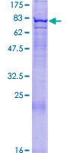 Novus Biologicals Recombinant Human FBXO24 GST (N-Term) Protein 10 &mu;g | Buy Online | Novus Biologicals&trade; | Fisher Scientific