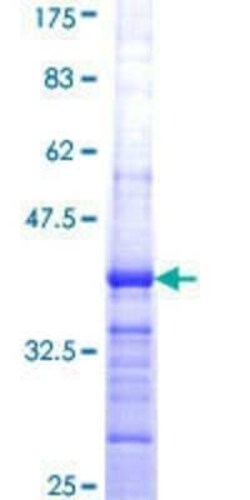 Novus Biologicals Recombinant Human FBXO24 GST (N-Term) Protein 10 &mu;g | Buy Online | Novus Biologicals&trade; | Fisher Scientific