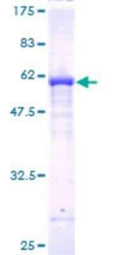 Novus Biologicals Recombinant Human FBXO22 GST (N-Term) Protein 25 &mu;g | Buy Online | Novus Biologicals&trade; | Fisher Scientific