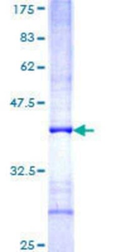 Novus Biologicals&trade;&nbsp;Recombinant Human FBX10 GST (N-Term) Protein