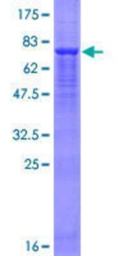 Novus Biologicals Recombinant Human FBX09 GST (N-Term) Protein 25 &mu;g | Buy Online | Novus Biologicals&trade; | Fisher Scientific